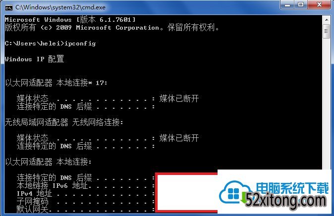 win10ipconfigʾڲô죿